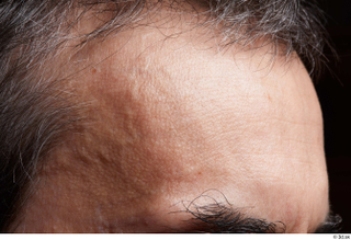 HD Face Skin Numair Toure face forehead hair skin pores…